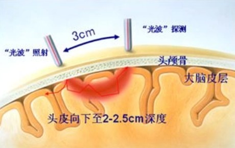 前沿 | 关于近红外，你所不知道的应用研究！