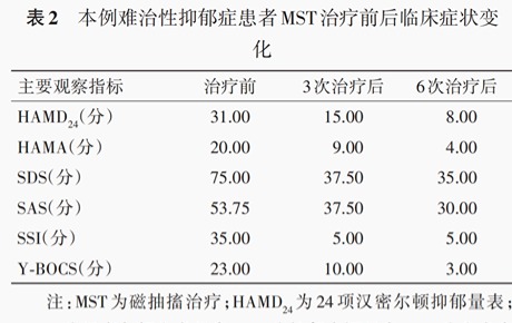 依瑞德独家mst支撑的首篇研究论文发表